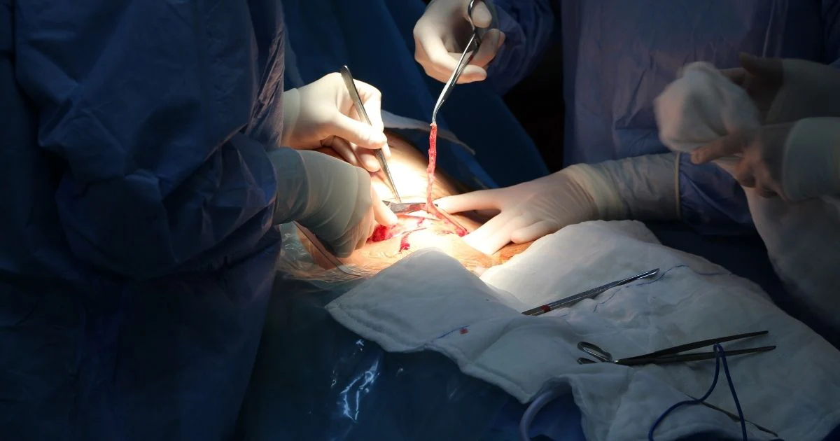 7 Tips for Preventing a Caesarean Delivery